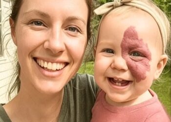 Родимое пятно судьбы